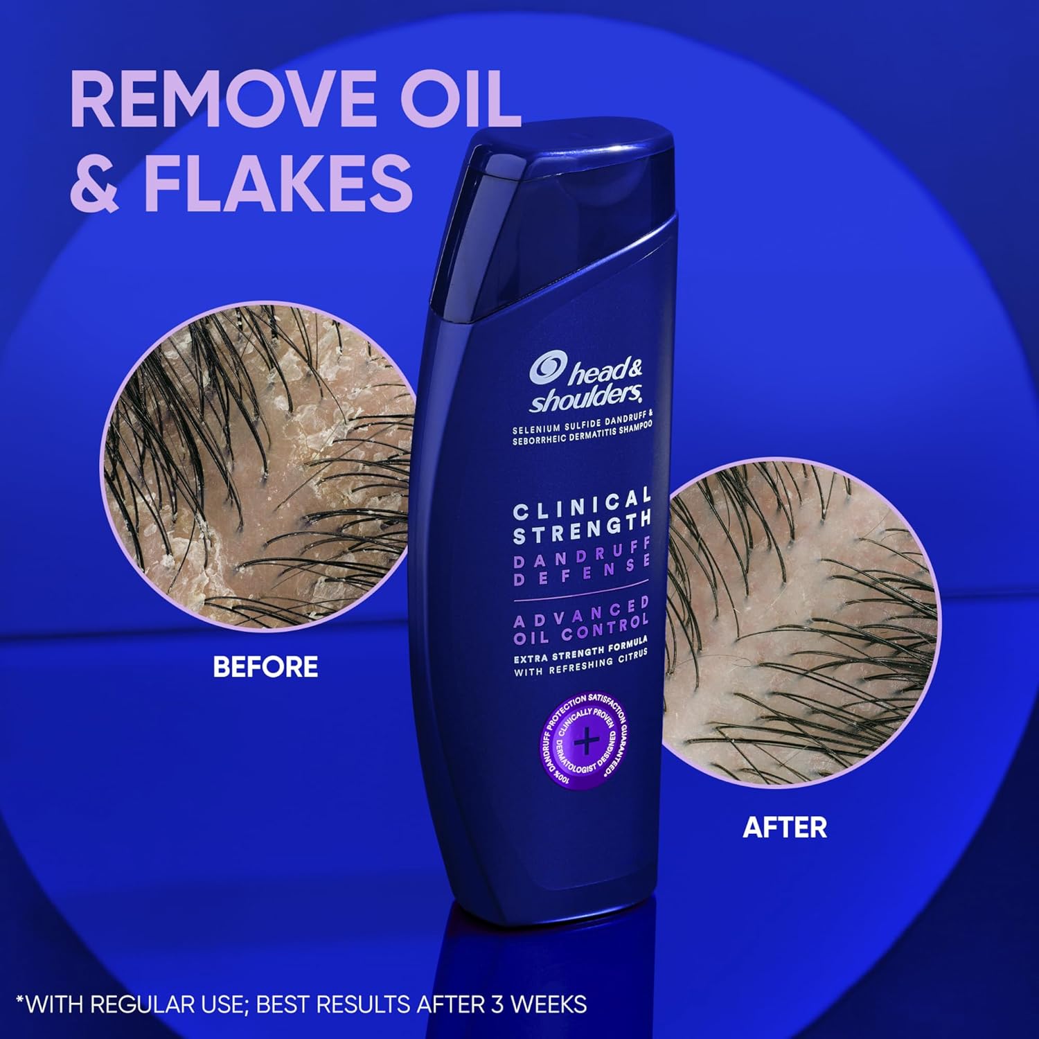 Head & Shoulders Clinical Strength Dandruff Shampoo - Advanced Oil Control (Twin Pack)